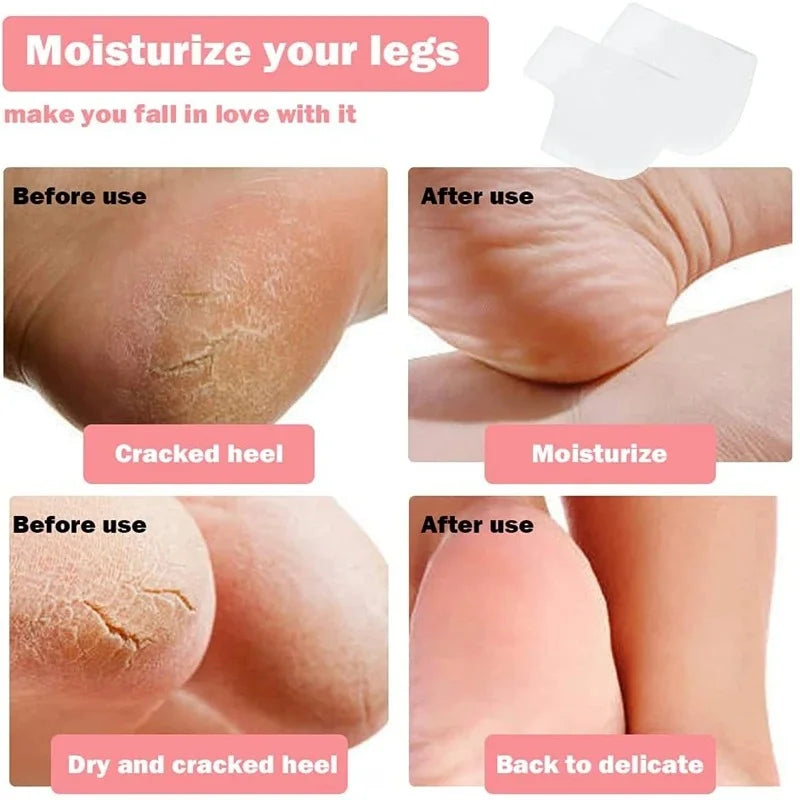 Silicone Heel Pads